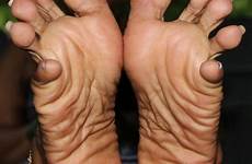 soles toes feetfixations
