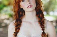 freckles redheads alea heads rood wiles frey