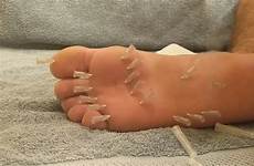 feet needles thisvid rating