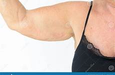 arm flabby woman senior aging effect showing muscle elasticity stock