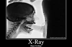 xray throat blowjob deep ray next ebaumsworld videos
