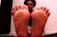 feet oily