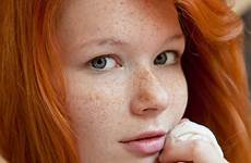 sollis redhead freckles redheads casper skinned pasty revlt