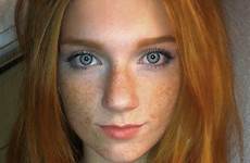 freckles redhead red redheaded people saved beautiful hair love