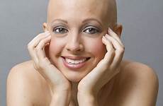 bald going women hair blinkhorn aimee want girl girls loss show happy started nothing model ashamed now without fetish wig