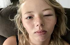 eye girl mask her open pain left after teen reaction kmart school daughter sleep burning minutes saturday five since through