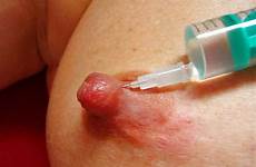 saline injection torture breast