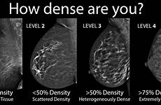 breast density mammogram cancer dense women breasts ultrasound anatomy risk if reduce decrease tissue look been mri fatty not when