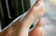feet soles toes nails