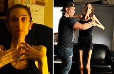 rachael anorexia farrokh anorexic woman after treatment thanks 200k nearly donors raising supporters disorders severe eating still who thanking her