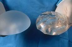 breast implants surgery