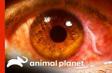 parasite eyeball