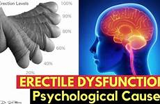 erectile dysfunction causes psychological