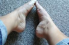 soles arches wrinkles