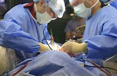 penis enlargement surgery erection after man file eight botched months has fox ap foxnews