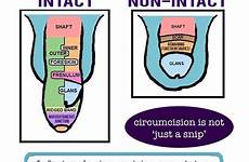 circumcision healing intact