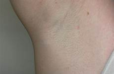 armpits female armpit