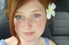 annah freckles freckle redheads freckledgirls
