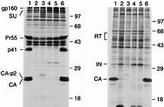 gag schematic representation mutants particle sufficient precursor immunodeficiency type