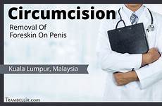 circumcision penis foreskin trambellir