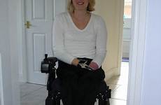 quad amputee amps prosthetic leg wheelchairs disability