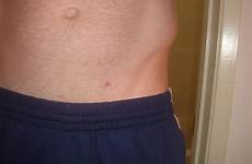 stomach bump tiny lower actually its real side right above waist but line