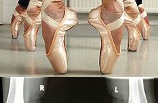 ballerinas know should hardcore than ballerina ballet toes feet pointe shoes look their entire put weight literally body big dancer