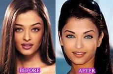 aishwarya rai surgery plastic nose job celebrity before after she celeb her implant actresses celebrities indian cheek choose board