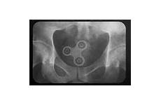 anus rectum objets gloryhole