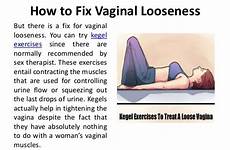 vaginal tightness looseness