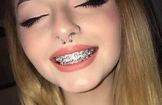 braces piercing girls colors cute face makeup piercings brackets smiley facial smile brace teeth girl pink pretty women mujer para