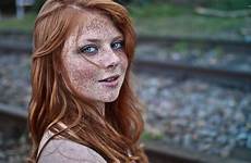freckled freckles freckle redheads suwalls