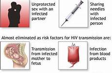 hiv transmission aids mother sex transmitted infection through unprotected virus blood spread health contaminated immunodeficiency human has fetus adam times