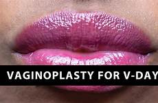 vaginal lip rejuvenation