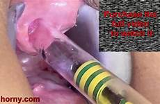 insertion urethral peehole eporner endoscope camera girl