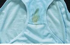 stains vaginal