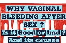 sex bleeding after vaginal bad good