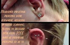 piercing keloid industrial bump piercings choose board resolve elsewhere trying done am infected red