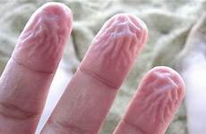 fingers wrinkly