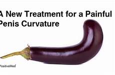painful curvature