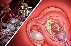 xray womb tentacle uterus nakadashi cumming futa pregnant cervix smutty cumflation izayoi touhou hayashi sakuya throat