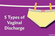 discharge vaginal infographic