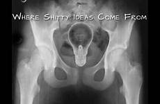 rays ass bizarre ray amazing random funny objects inserted object places into xray things dumpaday lesbian weird stuffing strange found