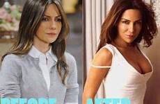 vanessa marcil before after boobs job surgery implants breast jessica plastic so