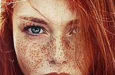 freckles hermosas