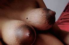 nipples mature tits amazing big xnxx forum adult
