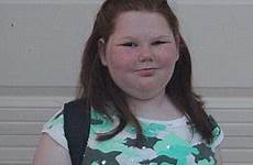 surgery teen girl obese pre brain school tumor alexis shapiro after her texas 50lbs gastric lighter returns had made who
