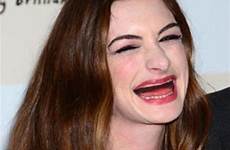 teeth actresses without freaky words too just anne hathaway izismile