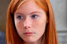 freckles redheads braces woman heads 2folie headed kastanjebruin refrence mostly freckle gingers redhair corps regard rood sommersprossen 24th