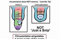 circumcision circumcise unkindest